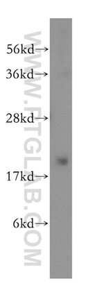 DCTD Antibody in Western Blot (WB)