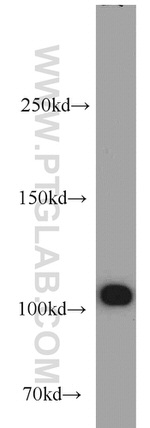 MPP8 Antibody in Western Blot (WB)
