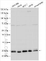 SNX24 Antibody in Western Blot (WB)