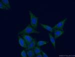 MRPL52 Antibody in Immunocytochemistry (ICC/IF)