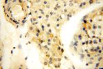 MRPL52 Antibody in Immunohistochemistry (Paraffin) (IHC (P))