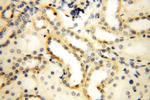 MRPL52 Antibody in Immunohistochemistry (Paraffin) (IHC (P))