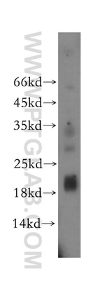 MRPL52 Antibody in Western Blot (WB)