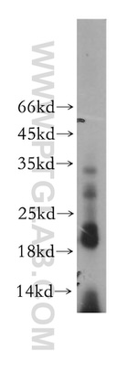 MRPL52 Antibody in Western Blot (WB)