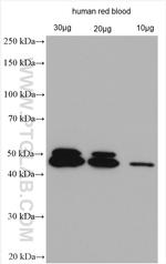 Dematin Antibody in Western Blot (WB)