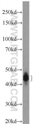 Dematin Antibody in Western Blot (WB)
