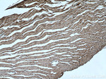 HSP20 Antibody in Immunohistochemistry (Paraffin) (IHC (P))