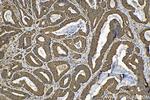 p130Cas Antibody in Immunohistochemistry (Paraffin) (IHC (P))