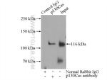 p130Cas Antibody in Immunoprecipitation (IP)