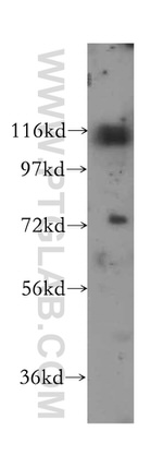 p130Cas Antibody in Western Blot (WB)