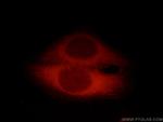 CC2D1A Antibody in Immunocytochemistry (ICC/IF)