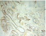 CC2D1A Antibody in Immunohistochemistry (Paraffin) (IHC (P))