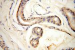 CC2D1A Antibody in Immunohistochemistry (Paraffin) (IHC (P))