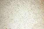 CC2D1A Antibody in Immunohistochemistry (Paraffin) (IHC (P))