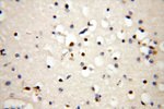 CC2D1A Antibody in Immunohistochemistry (Paraffin) (IHC (P))