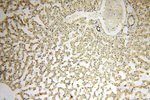 CC2D1A Antibody in Immunohistochemistry (Paraffin) (IHC (P))