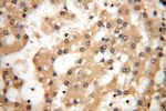 CC2D1A Antibody in Immunohistochemistry (Paraffin) (IHC (P))