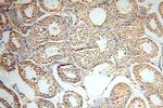 CC2D1A Antibody in Immunohistochemistry (Paraffin) (IHC (P))
