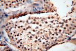 CC2D1A Antibody in Immunohistochemistry (Paraffin) (IHC (P))