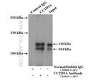 CC2D1A Antibody in Immunoprecipitation (IP)