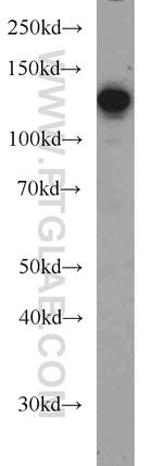 CC2D1A Antibody in Western Blot (WB)