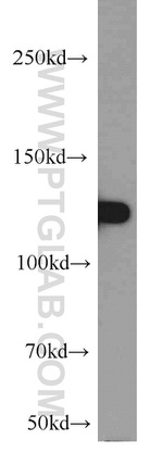 CC2D1A Antibody in Western Blot (WB)