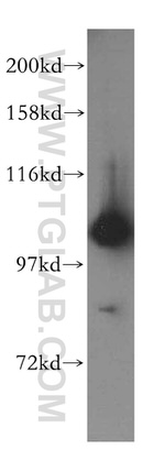 CC2D1A Antibody in Western Blot (WB)