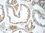 ZC3HAV1 Antibody in Immunohistochemistry (Paraffin) (IHC (P))