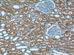ZC3HAV1 Antibody in Immunohistochemistry (Paraffin) (IHC (P))