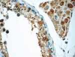 ZC3HAV1 Antibody in Immunohistochemistry (Paraffin) (IHC (P))