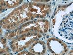 ZC3HAV1 Antibody in Immunohistochemistry (Paraffin) (IHC (P))
