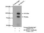 ZC3HAV1 Antibody in Immunoprecipitation (IP)