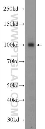 ZC3HAV1 Antibody in Western Blot (WB)