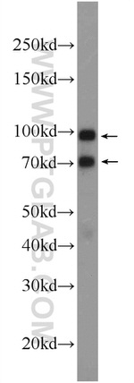 ZC3HAV1 Antibody in Western Blot (WB)