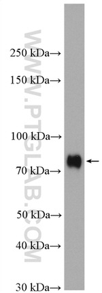 SRF Antibody in Western Blot (WB)