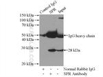 SPR Antibody in Immunoprecipitation (IP)