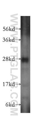 SPR Antibody in Western Blot (WB)