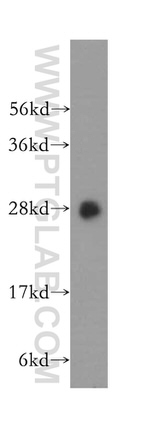 SPR Antibody in Western Blot (WB)