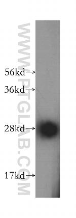 SPR Antibody in Western Blot (WB)