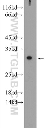 SPR Antibody in Western Blot (WB)