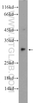 SPR Antibody in Western Blot (WB)
