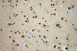 RBM26 Antibody in Immunohistochemistry (Paraffin) (IHC (P))