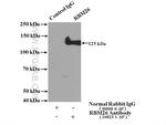 RBM26 Antibody in Immunoprecipitation (IP)