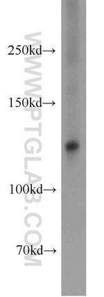 RBM26 Antibody in Western Blot (WB)