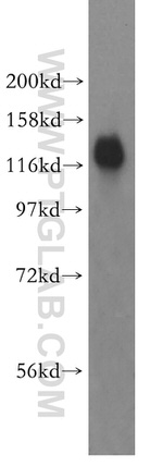 RBM26 Antibody in Western Blot (WB)