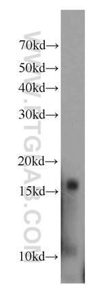 HBD Antibody in Western Blot (WB)