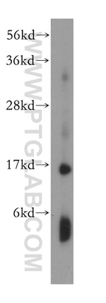 HBD Antibody in Western Blot (WB)