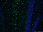 GFAP Antibody in Immunohistochemistry (PFA fixed) (IHC (PFA))