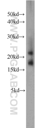 CNRIP1 Antibody in Western Blot (WB)