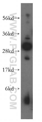 NIP30 Antibody in Western Blot (WB)